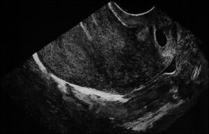 خط باریک قرمز