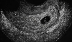 خط باریک قرمز